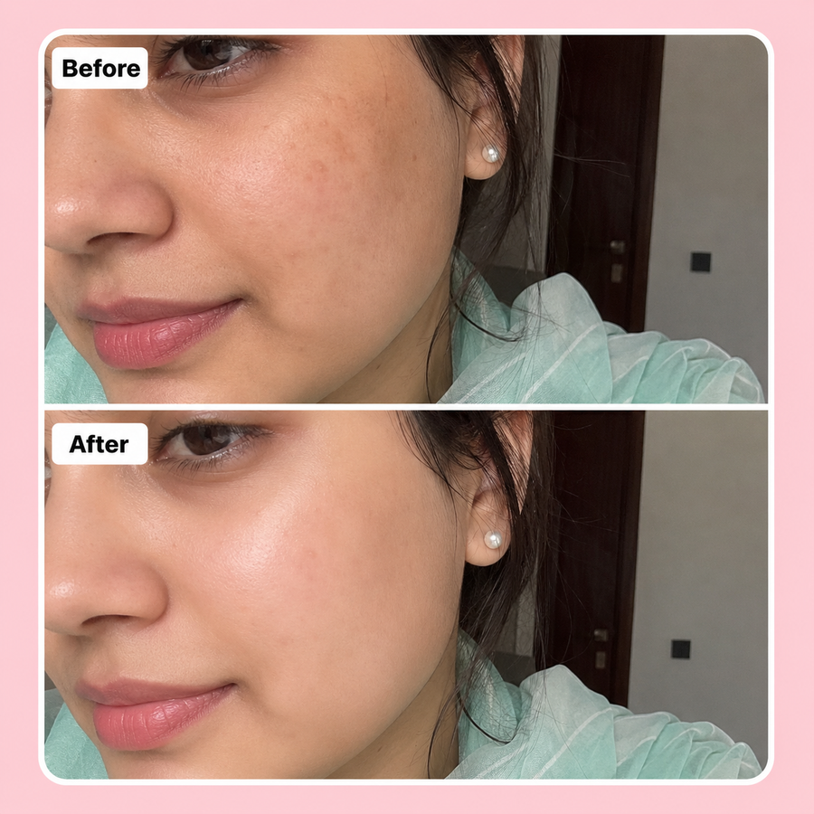 LURE Skin Brightening Deal results