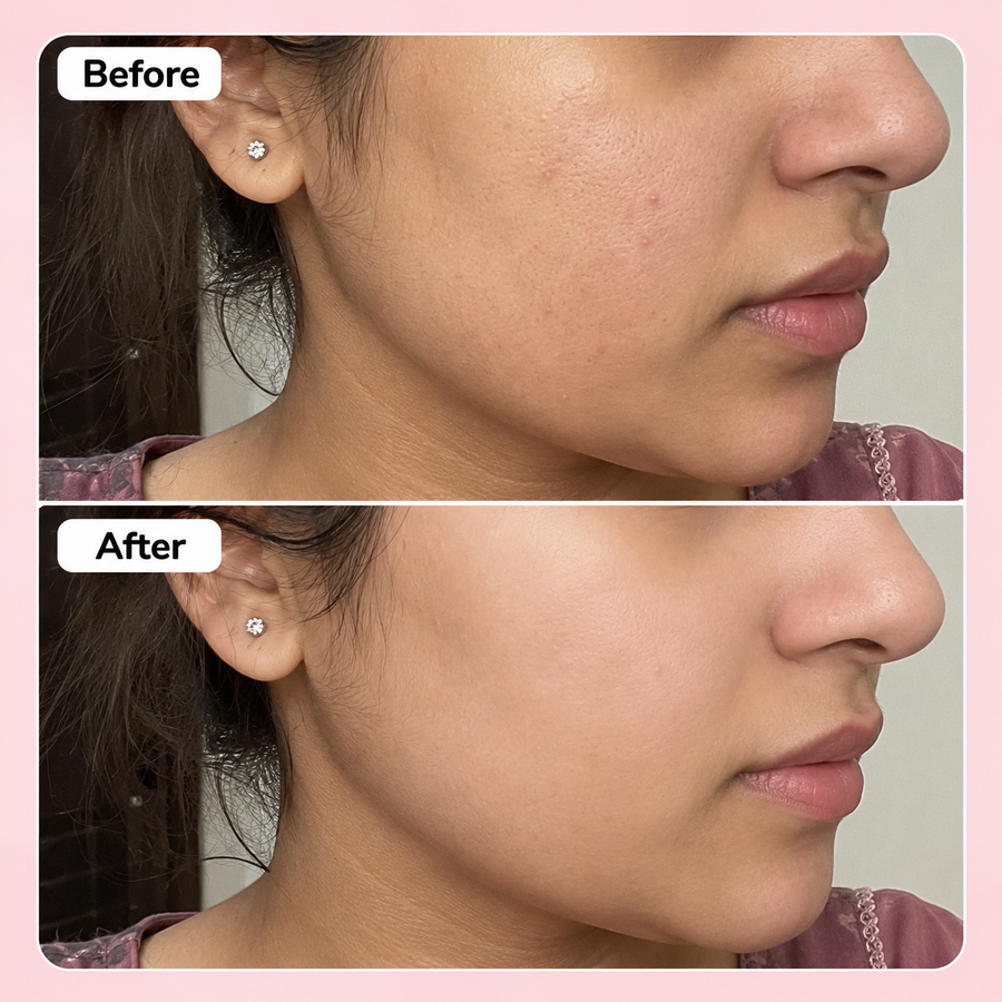 Niacinamide Serum 10% | Pores Minimizer Serum results