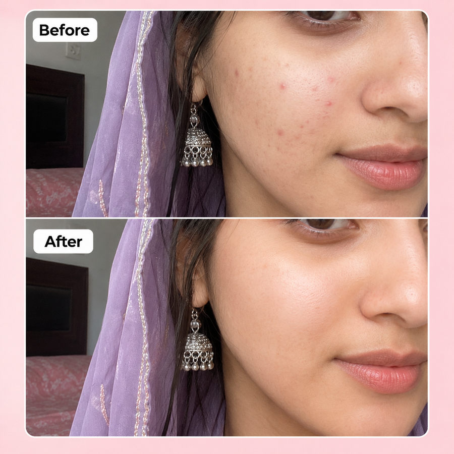 PURGE Mist | Hydrating Face Mist Spray results