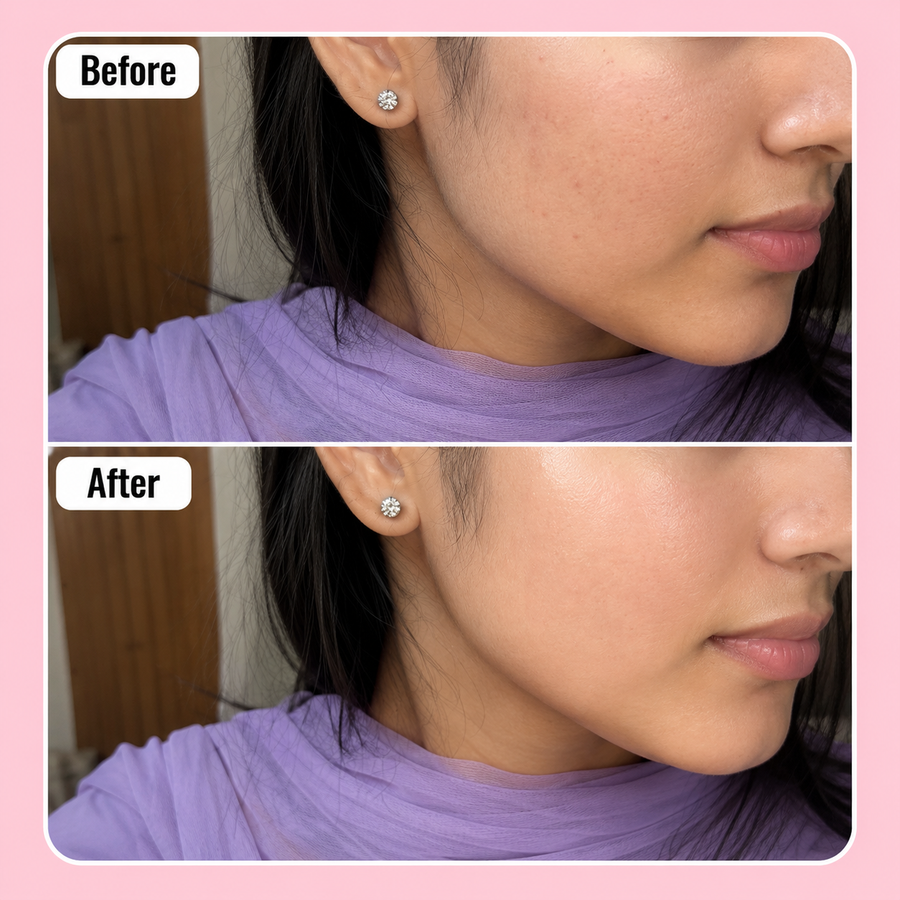 Wow 24k Gold Serum | 3% Kojic Acid results
