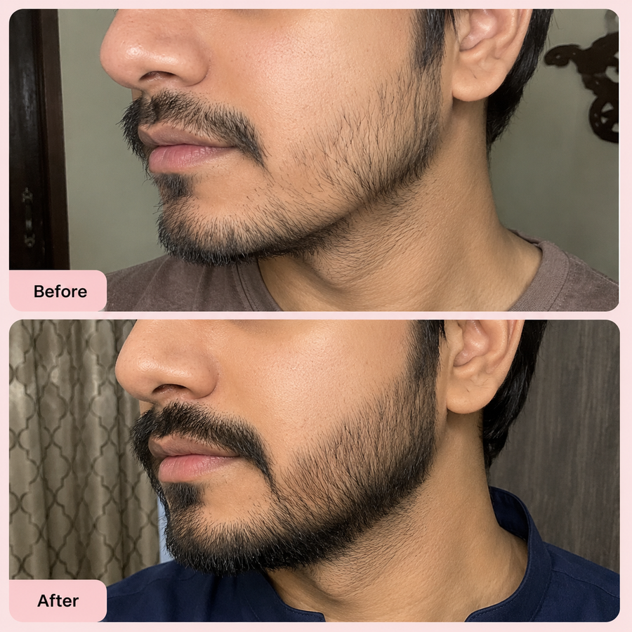 Beard Oil Pakistan - Beard Growth Oil results
