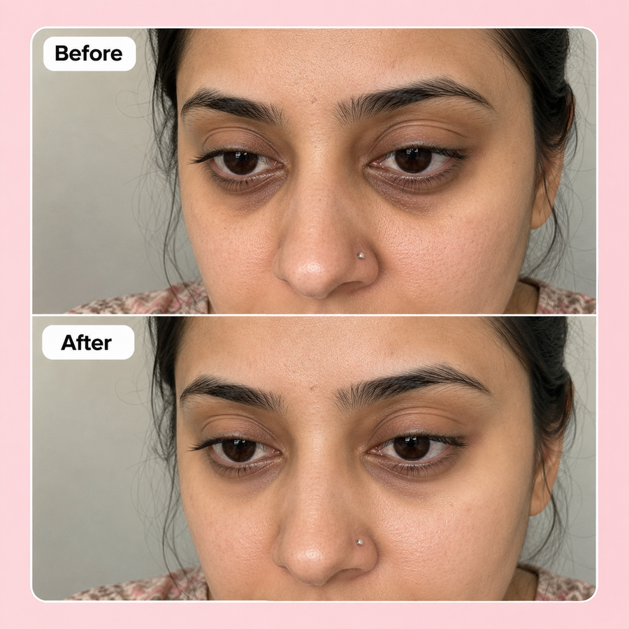Caffe Coco Dark Circle Serum results