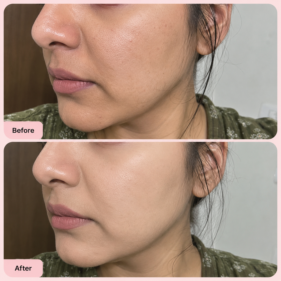 Full Coverage Base Kit results