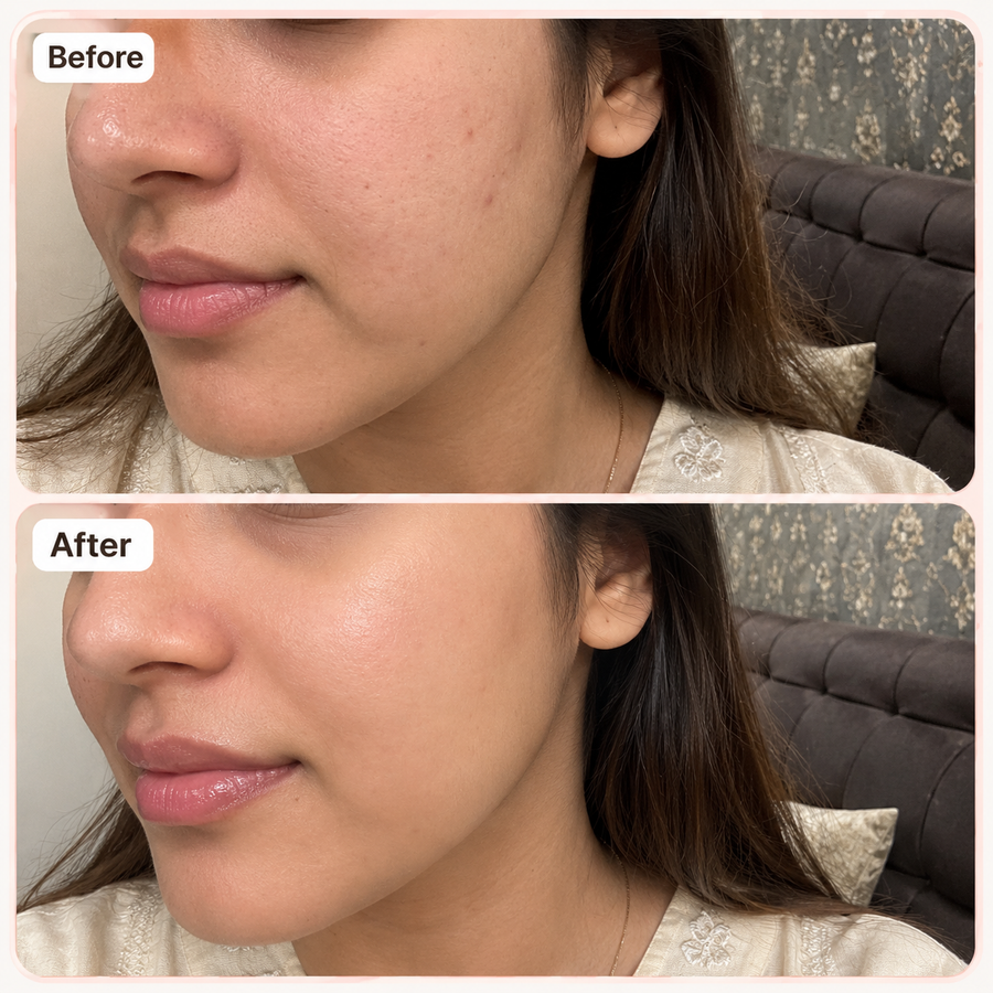 Brightening Glow Duo Kit results