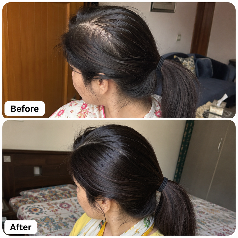Hair Growth Oil | 16 Oils Blend Hair Food results