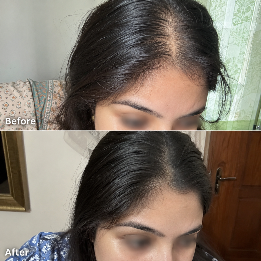 Hair Growth Oil | 16 Oils Blend Hair Food results