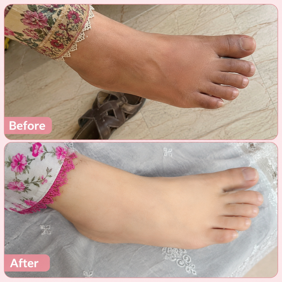 Hand & Foot Brightening Cream results
