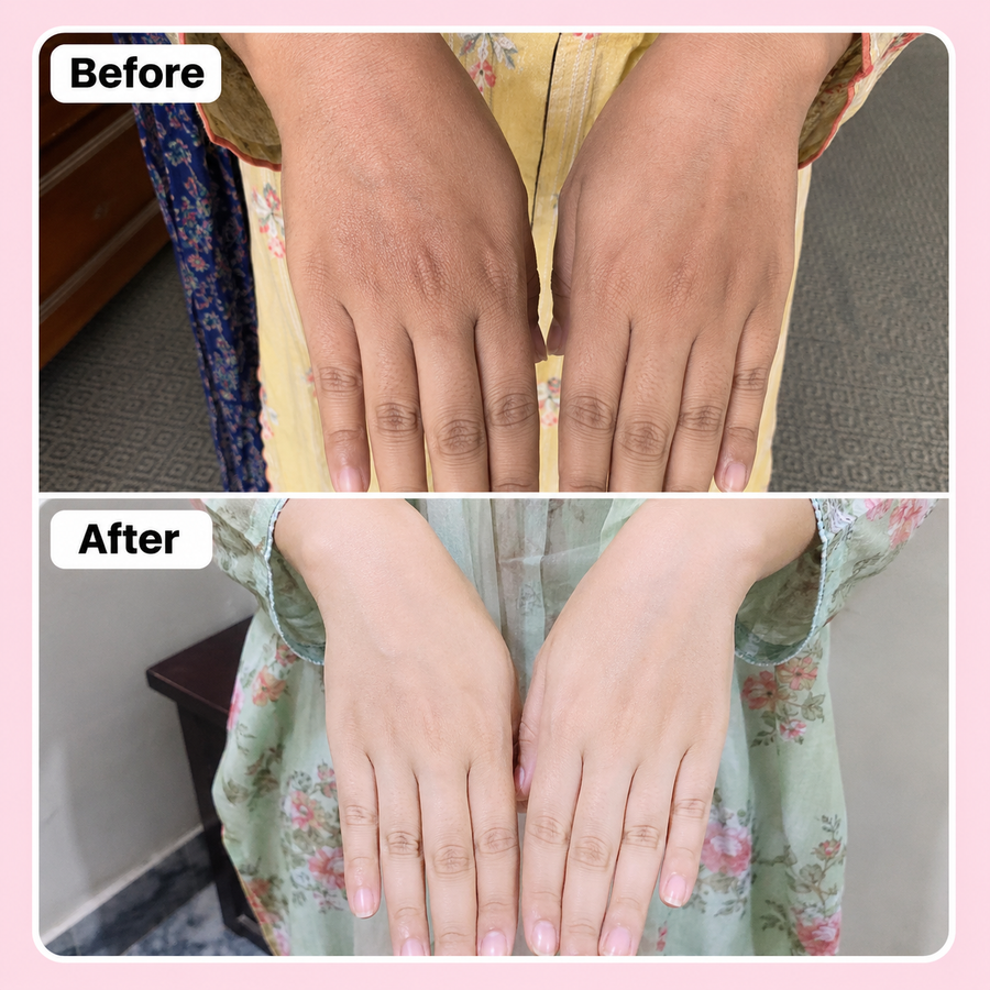 Hand & Foot Brightening Cream results