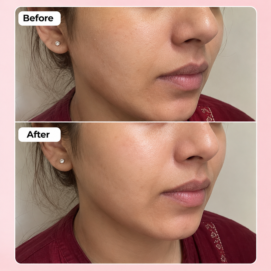 Hydration Boost Deal | Hyaluronic Acid Serum Deal results