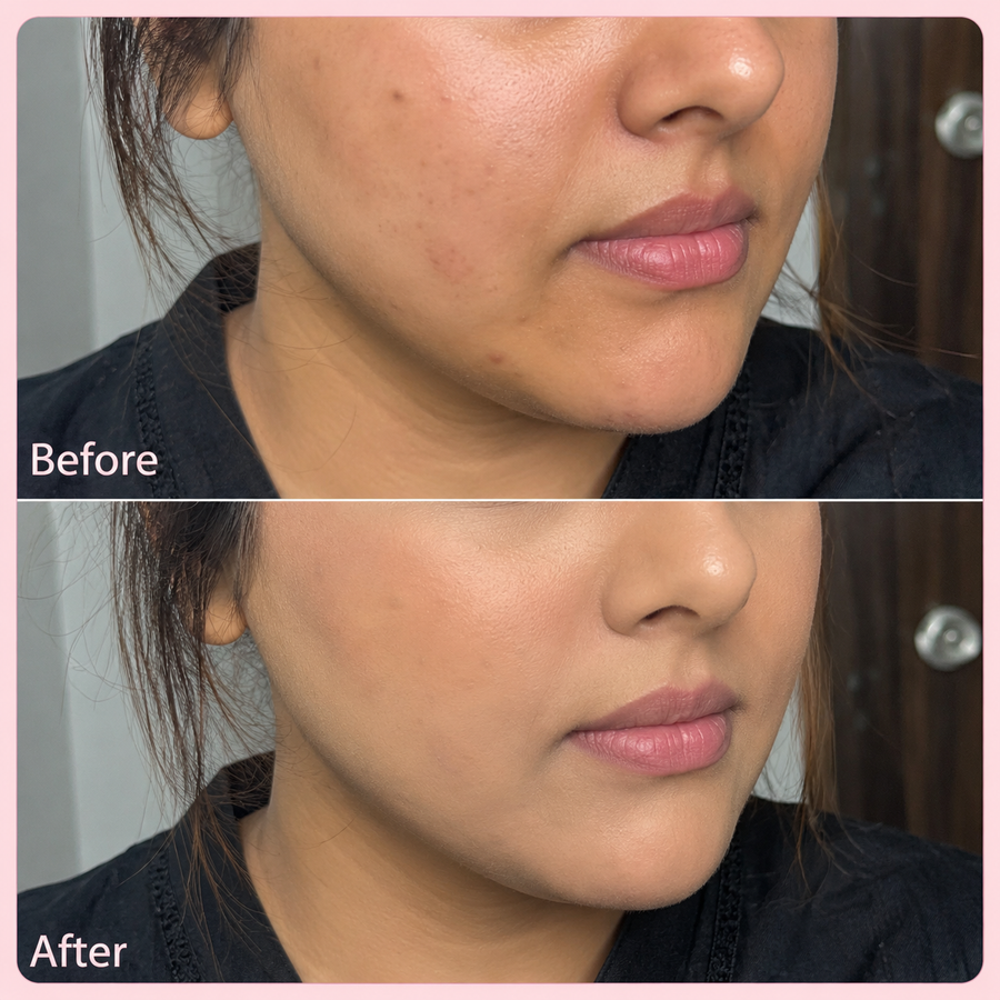 Wow 45 Shade Matte Base - Moose Base results