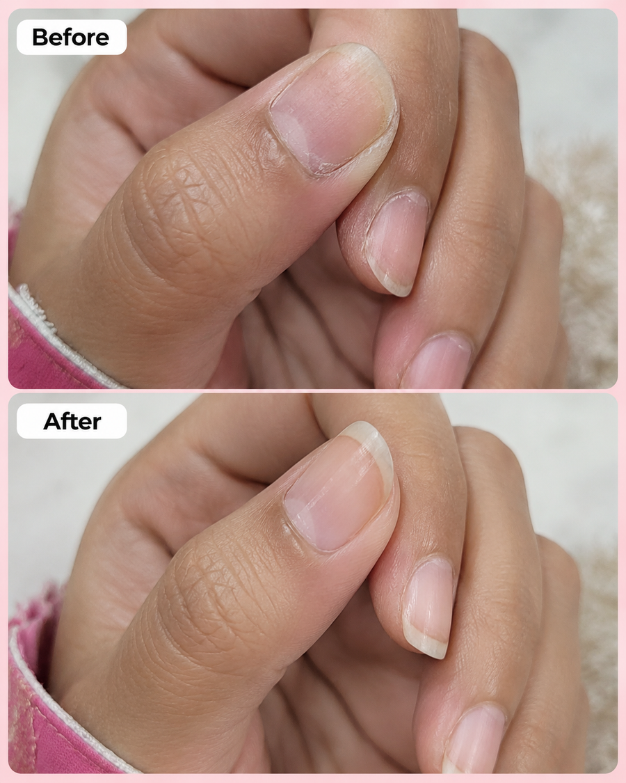Nail Growth Serum | Nail Strengthening Serum results