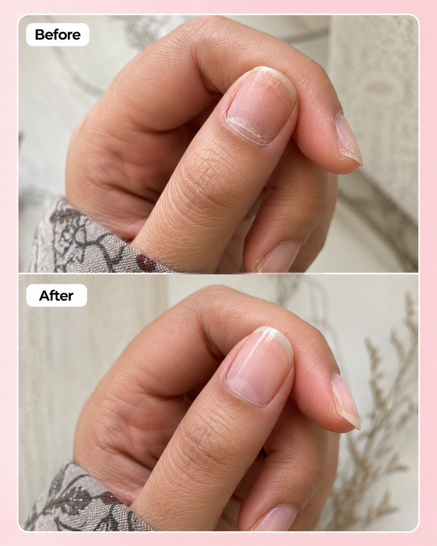 Nail Growth Serum | Nail Strengthening Serum results