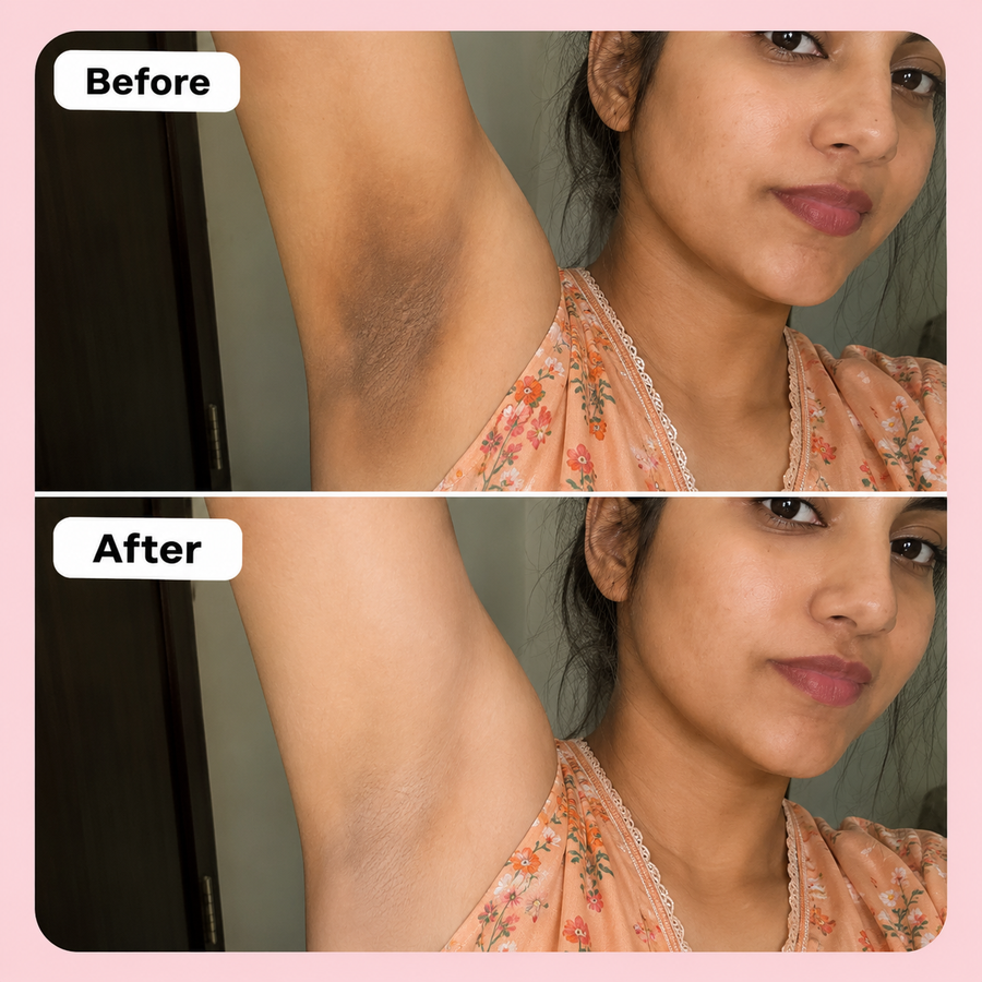 Private Part Brightening Cream results
