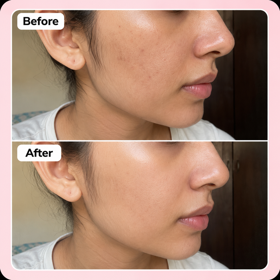 Rose Pink Skin Polish | Skin Polishing results