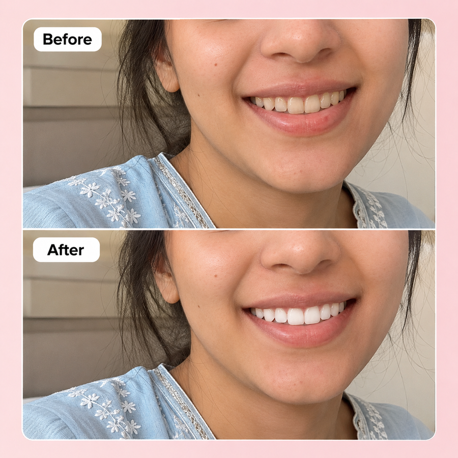 WOW WHITE Teeth Whitening Powder | Activated Charcoal Powder results