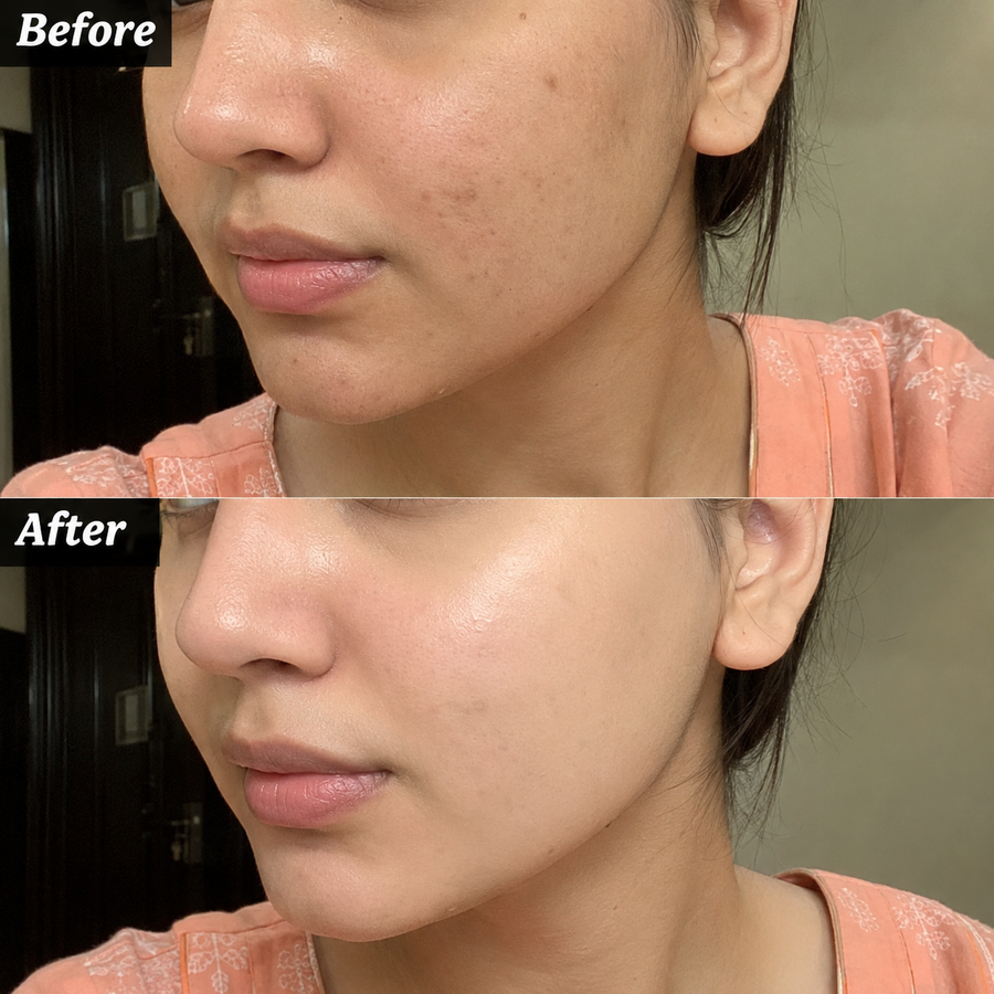 Wow Ubtan Powder | Brightening Mask results