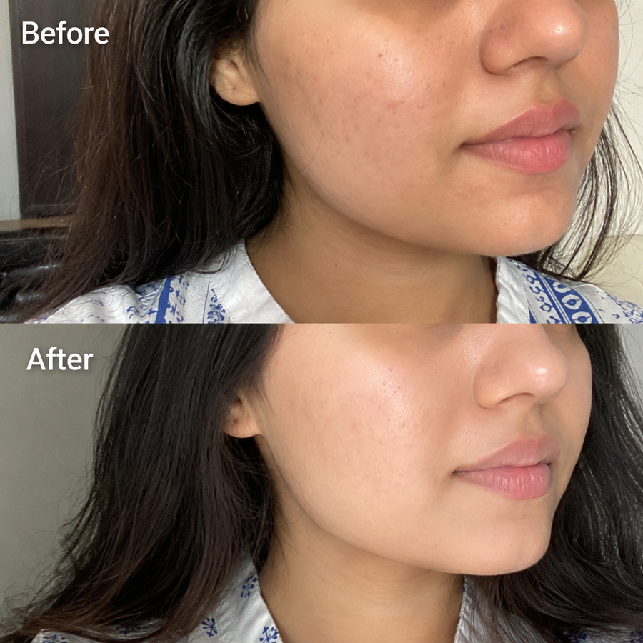 Wow Ubtan Powder | Brightening Mask results
