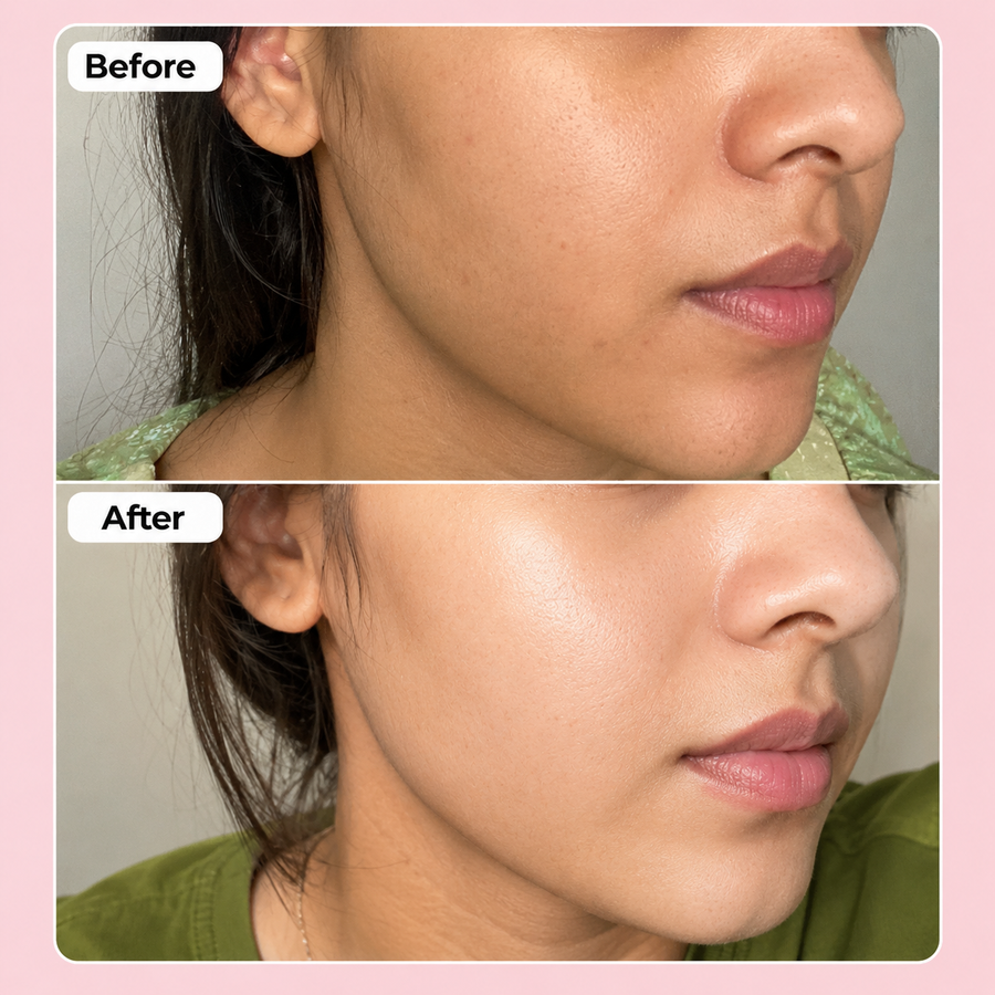 Vitamin C Skin Serum 10% results