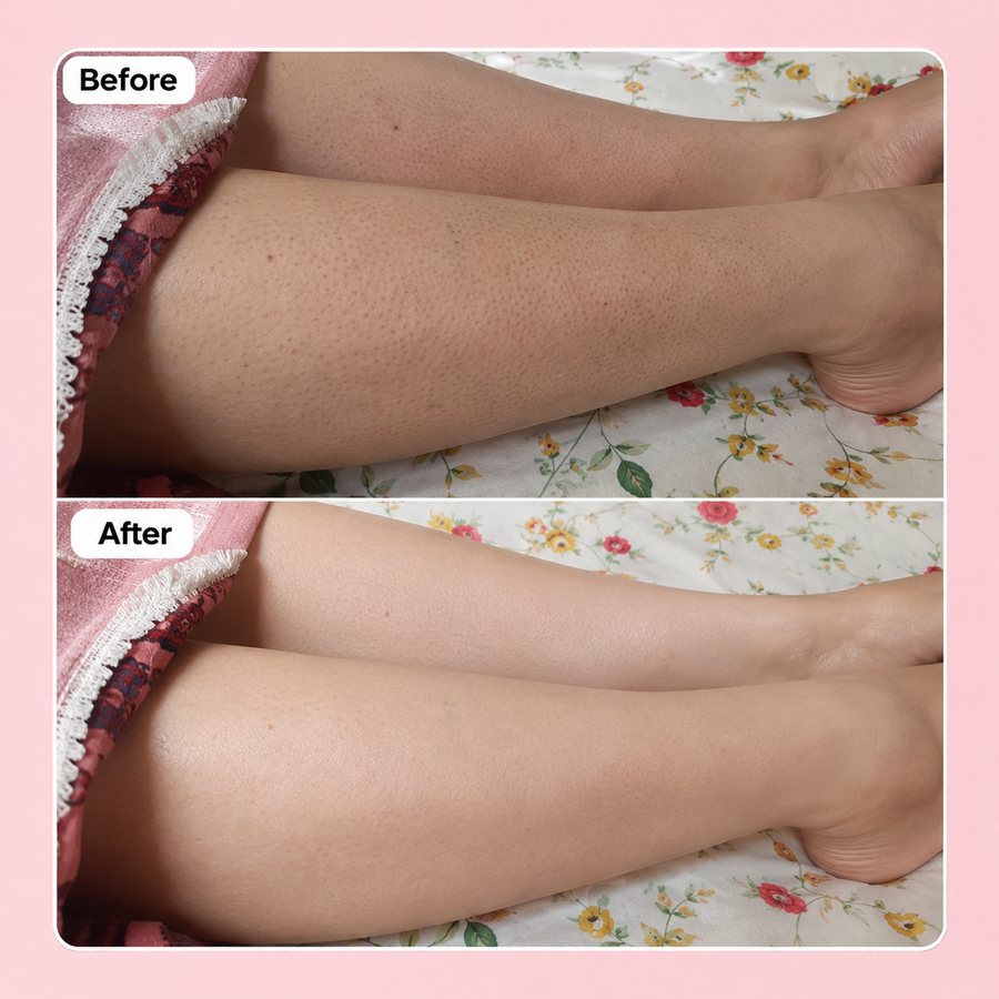 Wow Sugar Scrub | 2% Glycolic Acid results