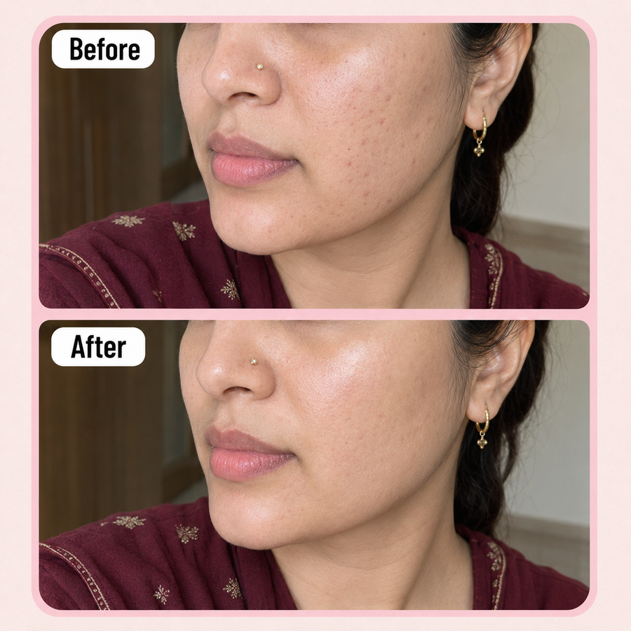 LURE Brightening Cream results