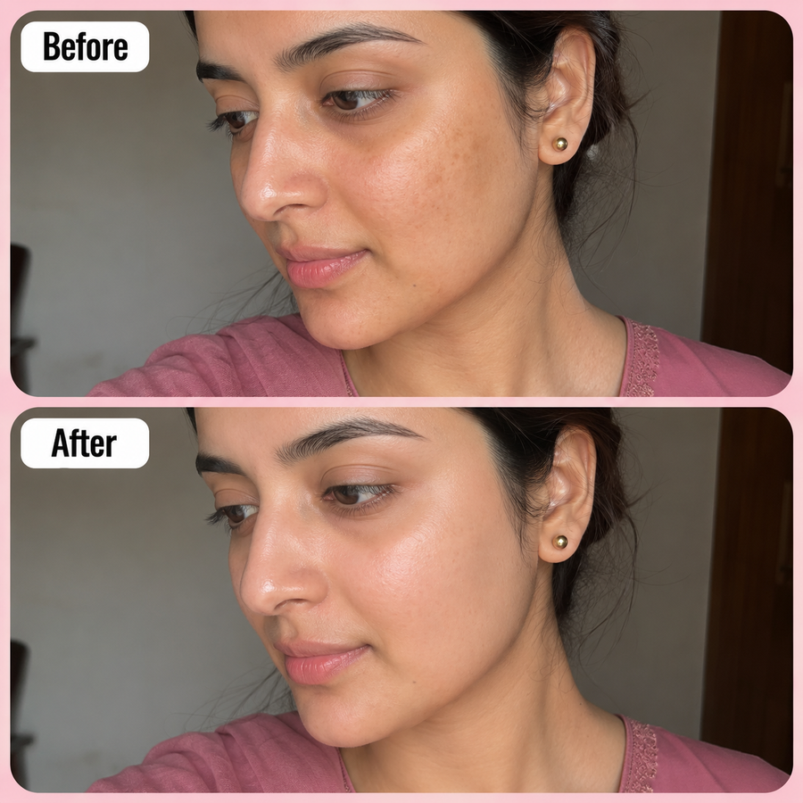 LURE Skin Brightening Deal results