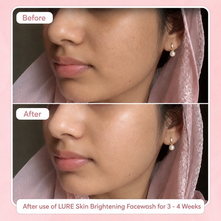 LURE Skin Brightening Deal results