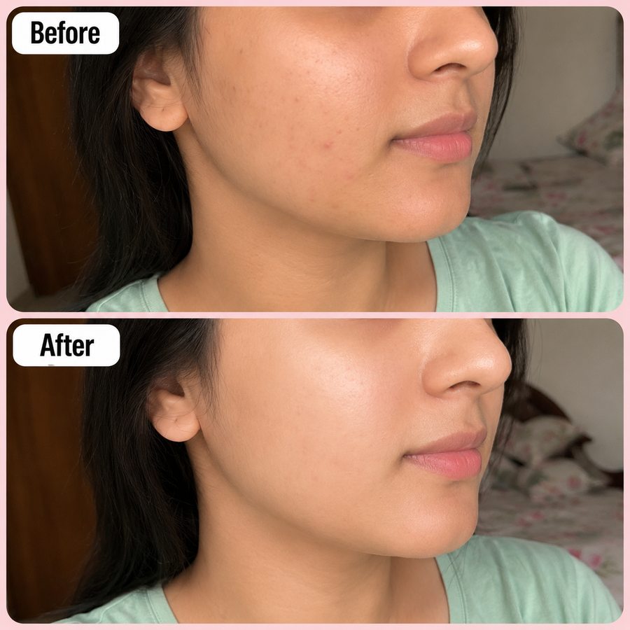 LURE Skin Brightening Deal results