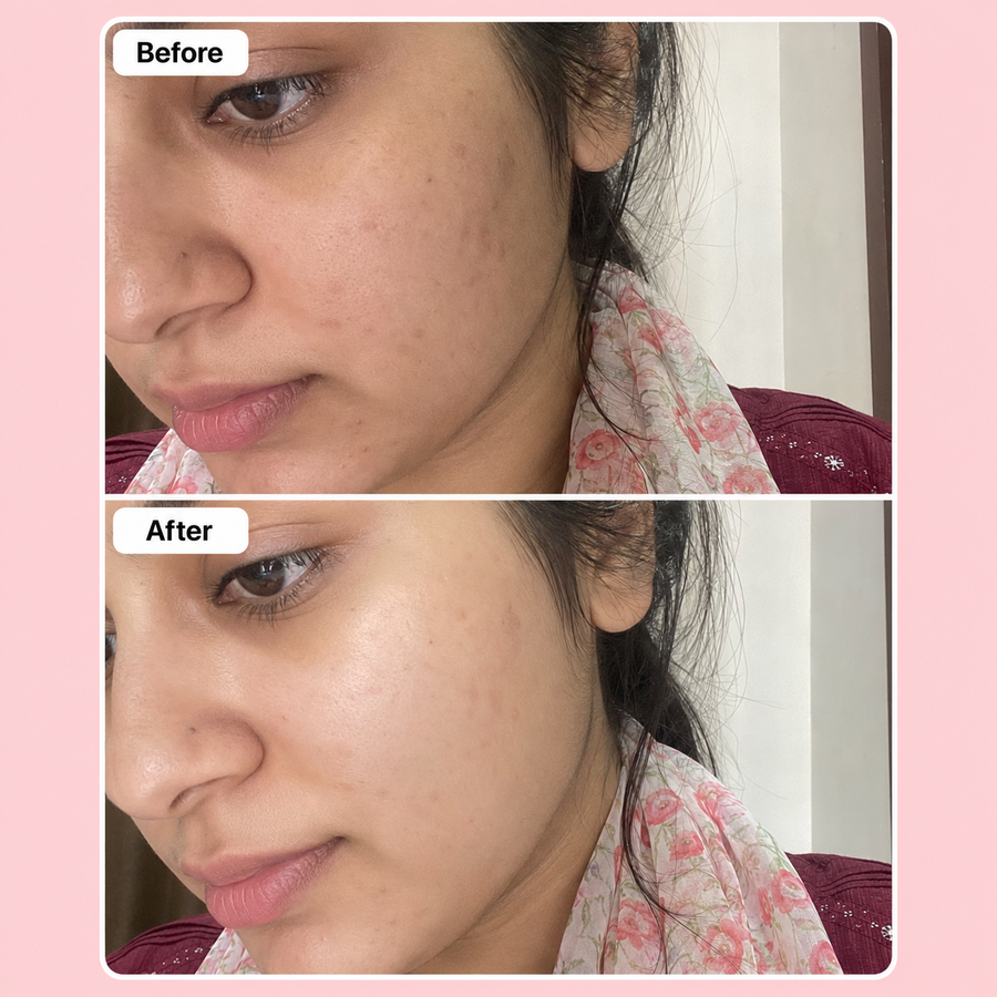 LURE Skin Brightening Deal results