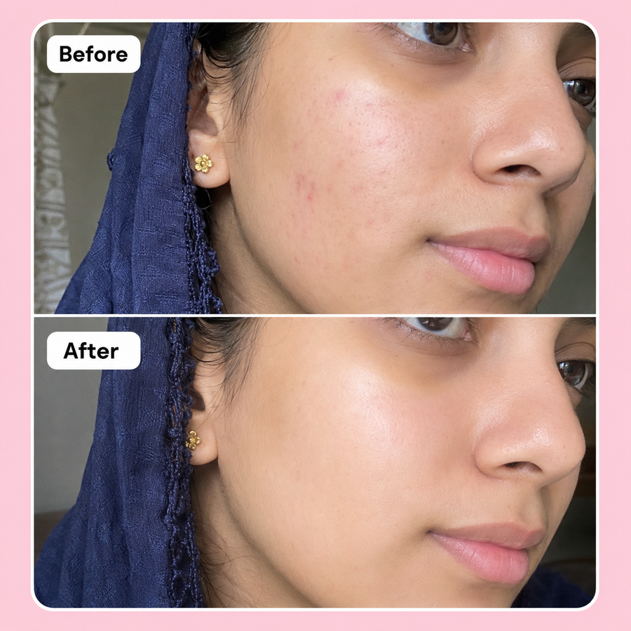 LURE Skin Brightening Deal results