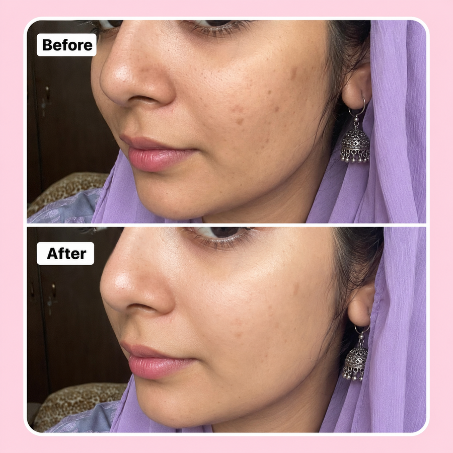 LURE Brightening Serum | 2% Alpha Arbutin results