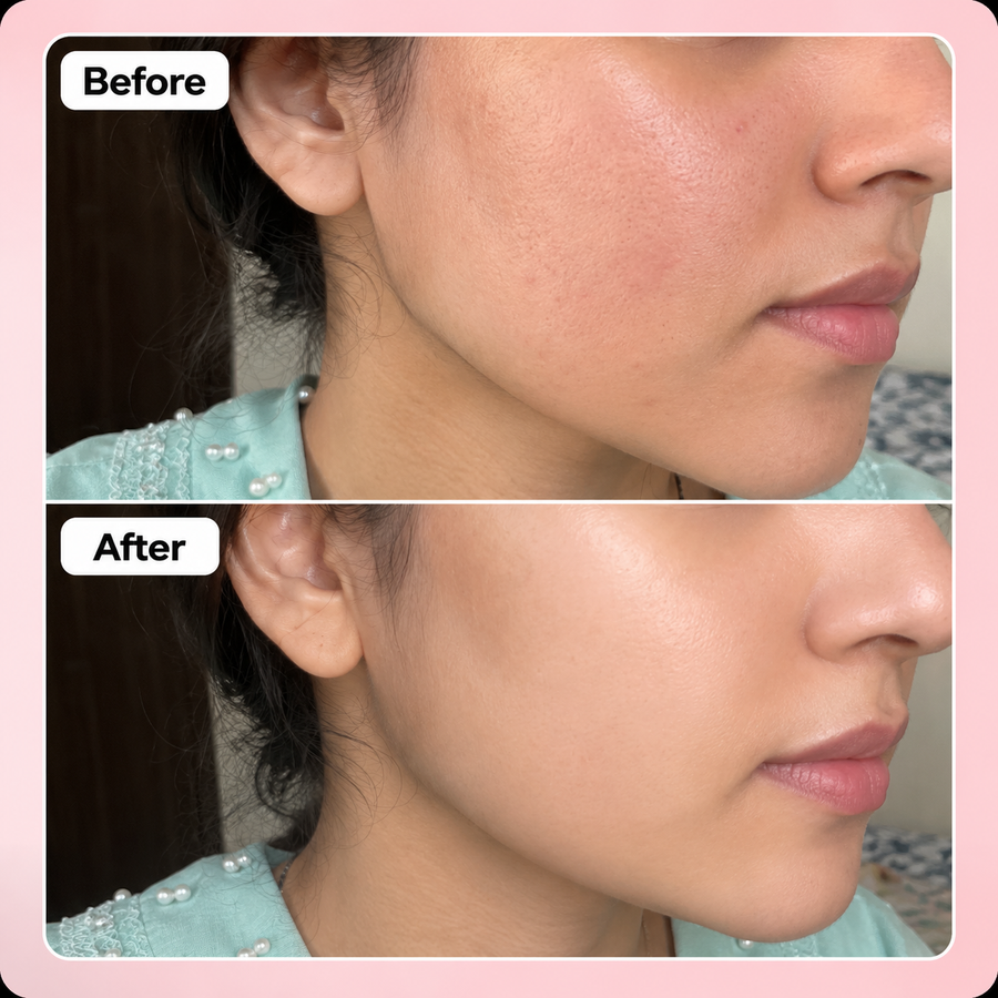 Pore Refining Duo Kit results