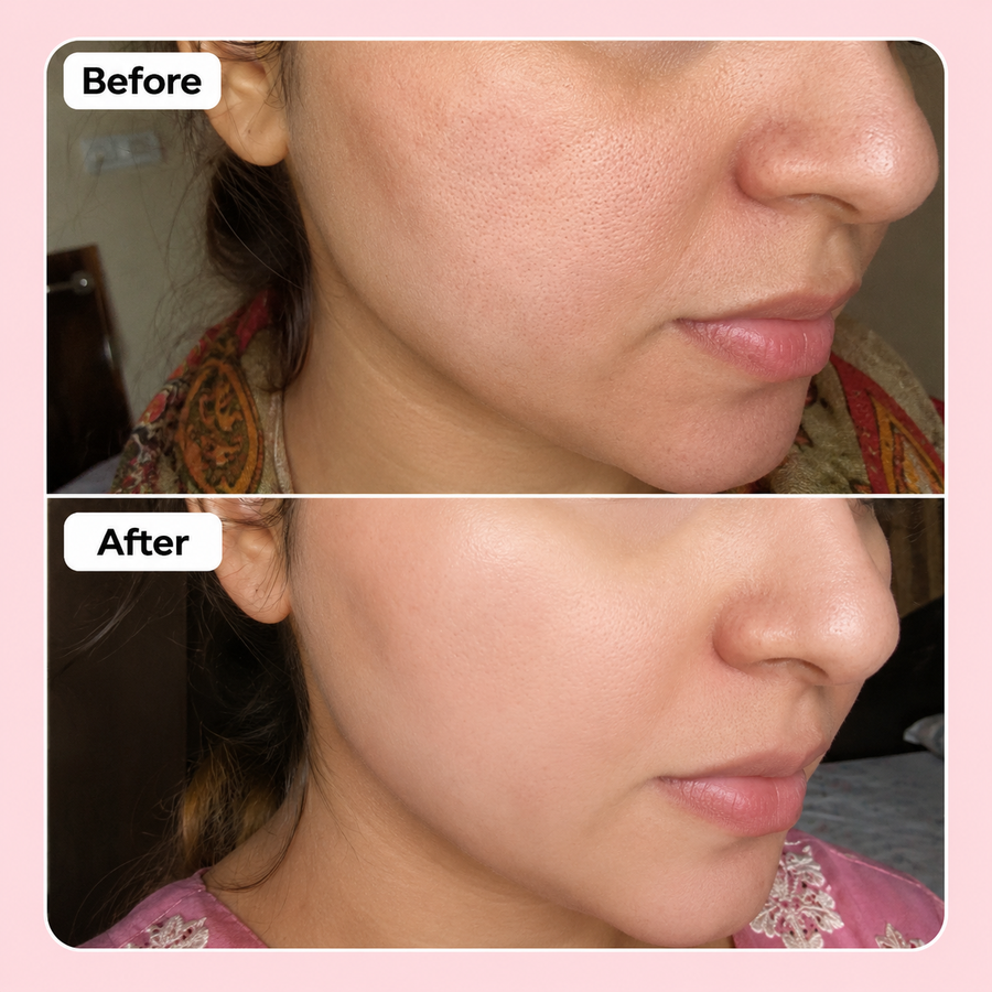 Pore Refining Duo Kit results
