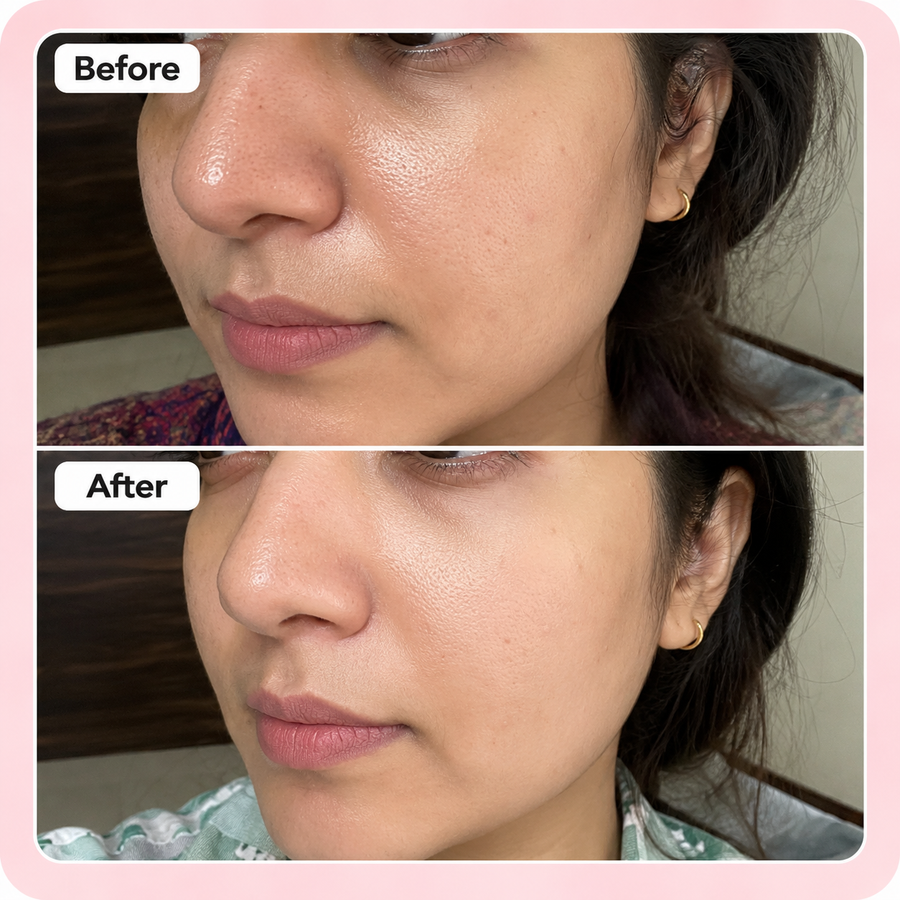 Pore Refining Duo Kit results