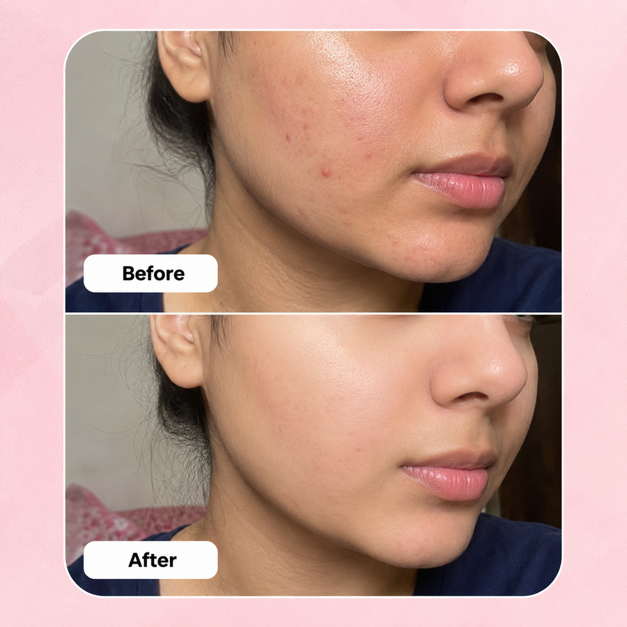 PURGE Cleanser results