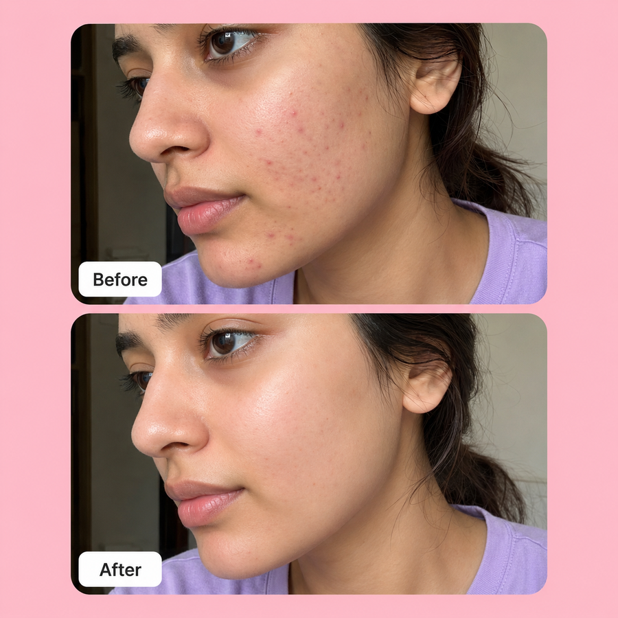 PURGE Mist | Hydrating Face Mist Spray results