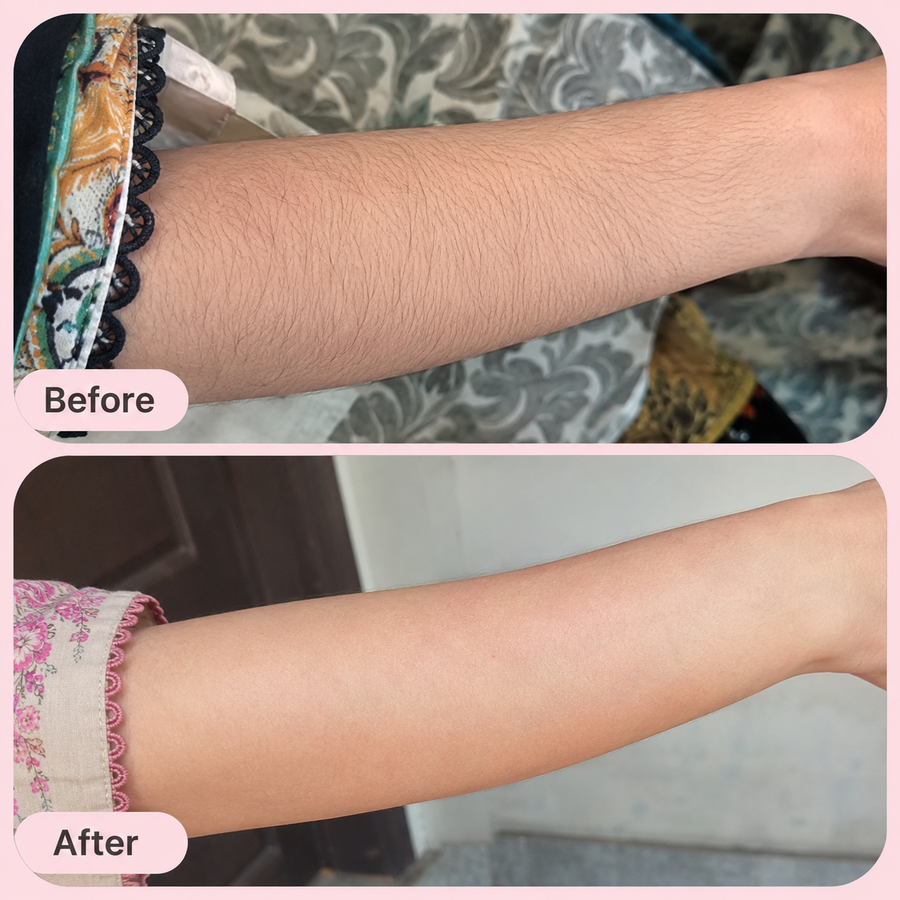 Hair Removal Inhibitor Spray | Hair Growth Reduction Spray results