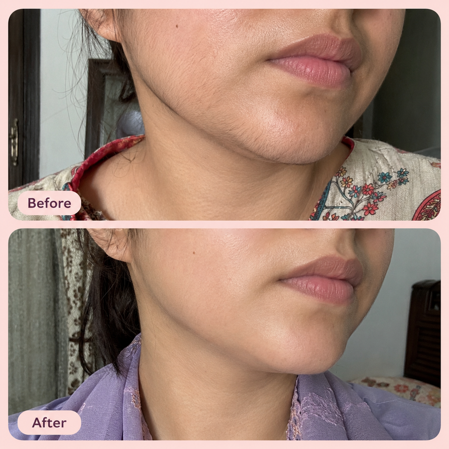 Hair Removal Inhibitor Spray | Hair Growth Reduction Spray results