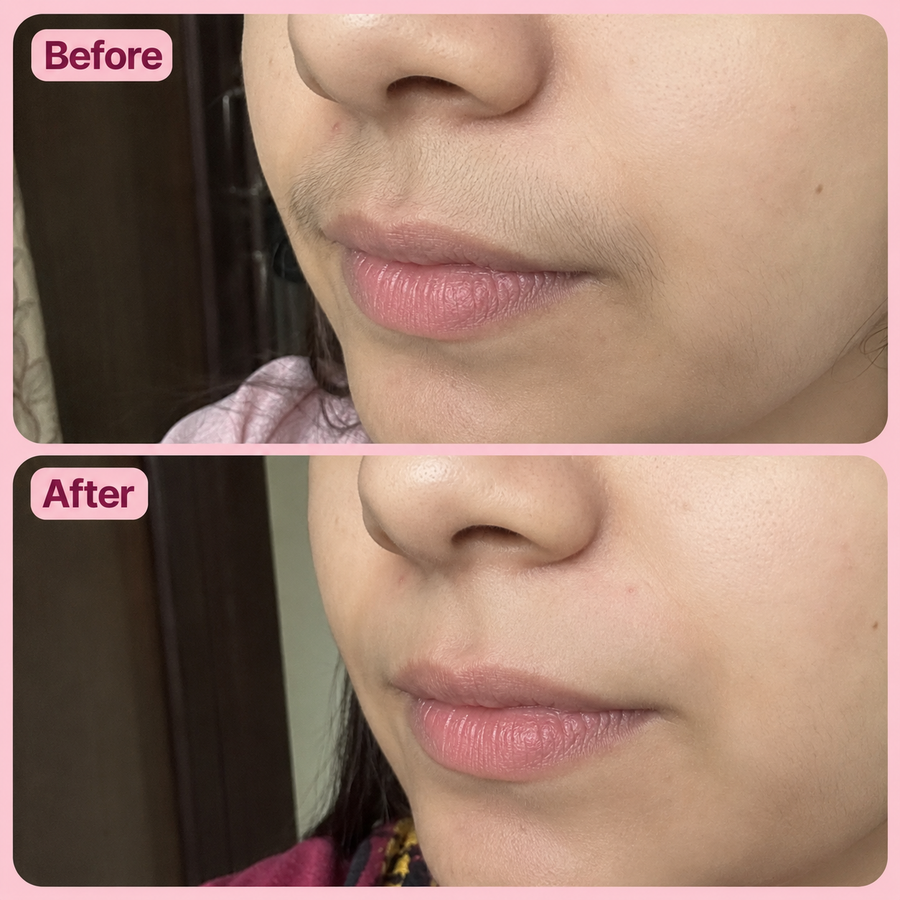 Hair Removal Inhibitor Spray | Hair Growth Reduction Spray results