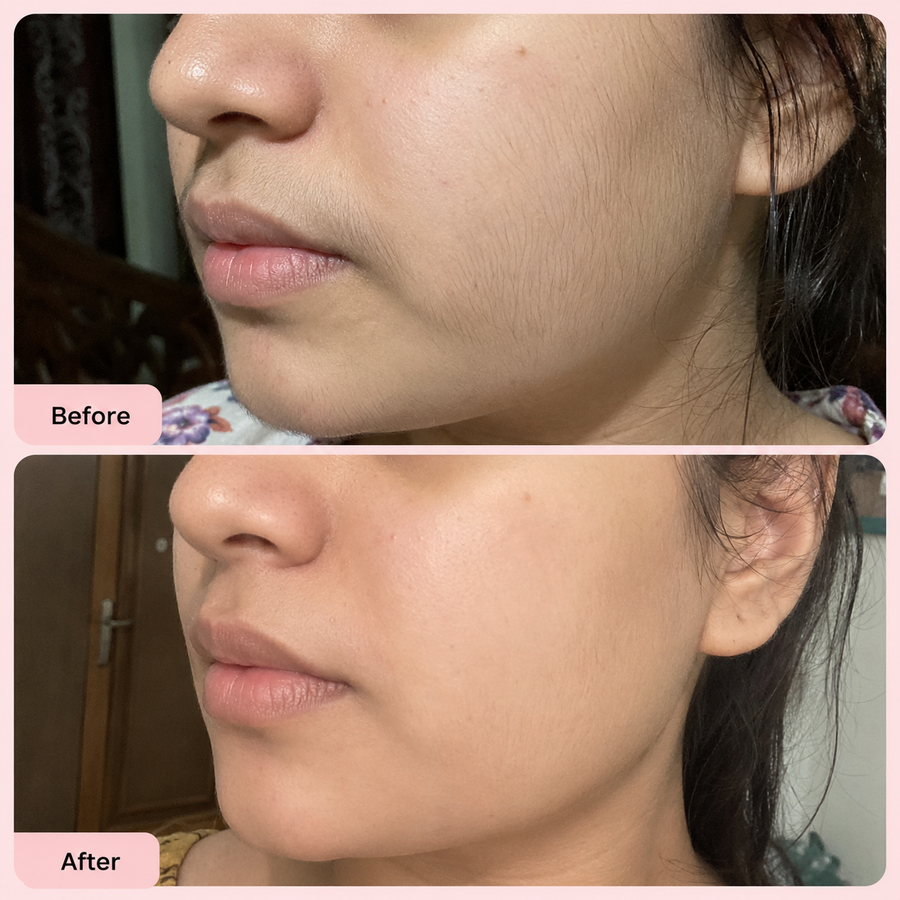 Hair Removal Inhibitor Spray | Hair Growth Reduction Spray results