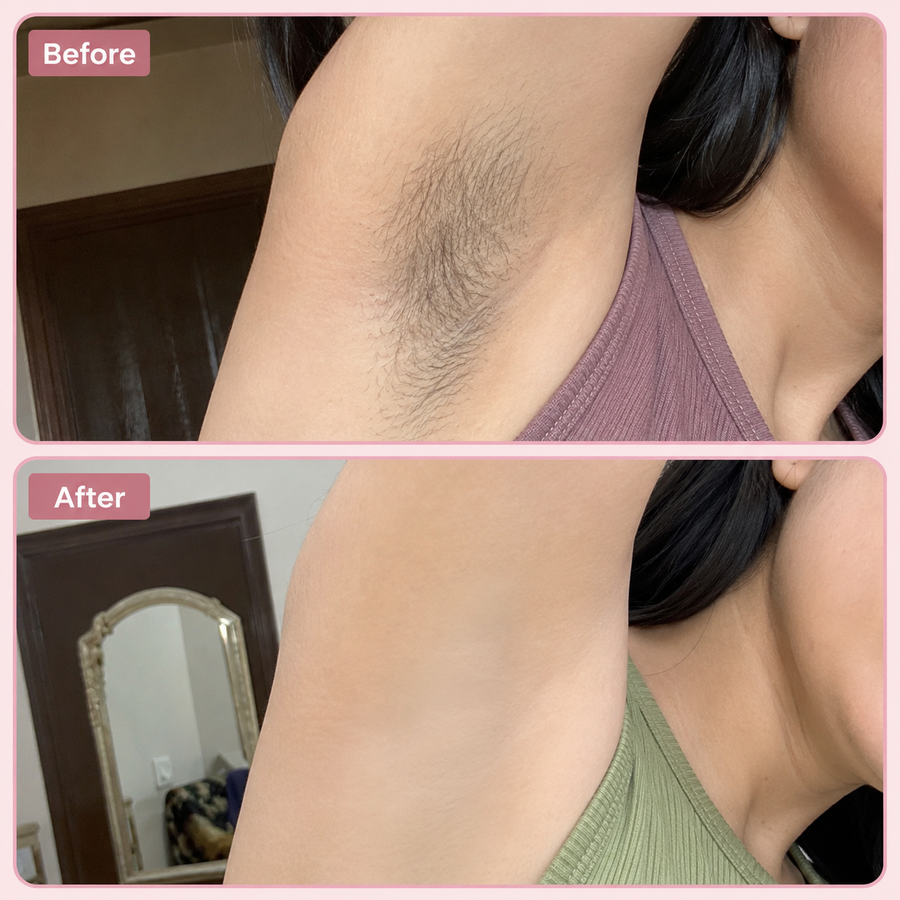Hair Removal Inhibitor Spray | Hair Growth Reduction Spray results