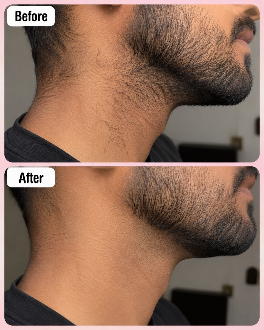 Hair Removal Inhibitor Spray | Hair Growth Reduction Spray results