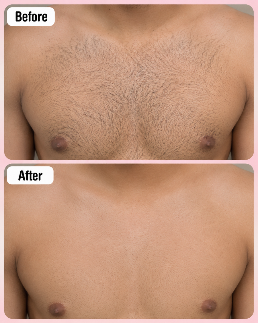 Hair Removal Inhibitor Spray | Hair Growth Reduction Spray results