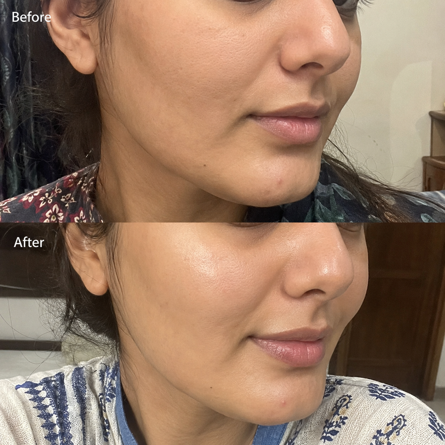 REVIVE Anti Aging Skin Care results
