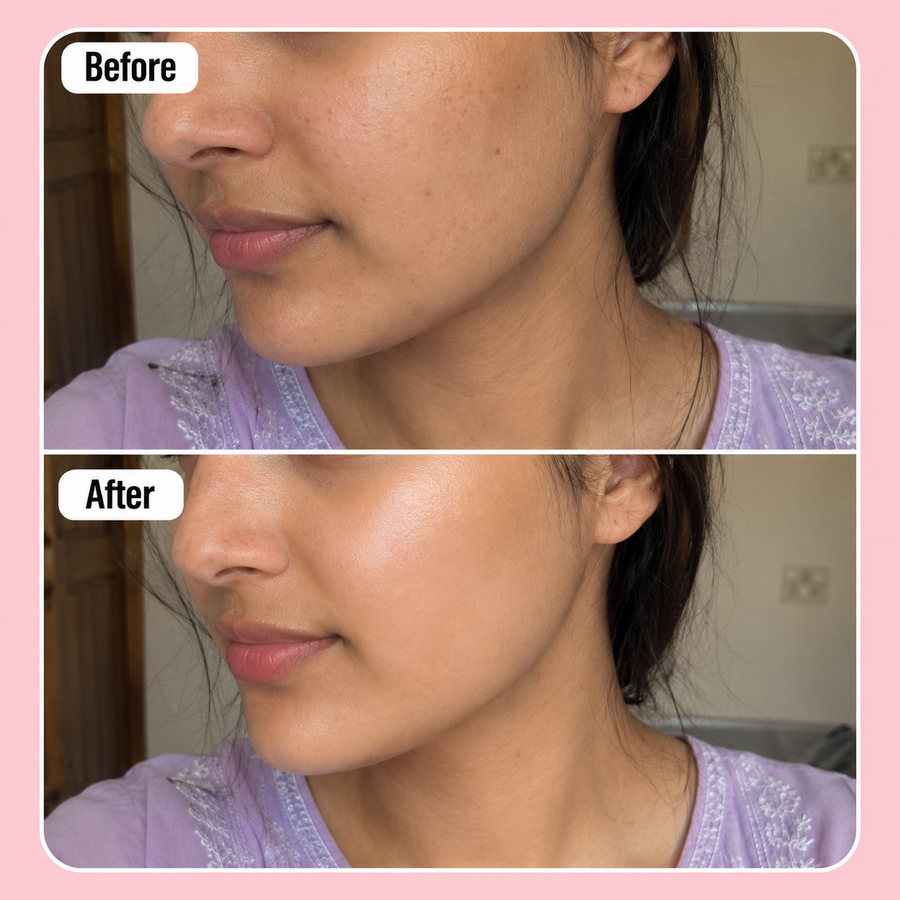 Wow 24k Gold Serum | 3% Kojic Acid results
