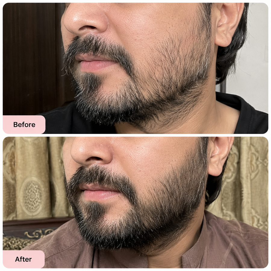 Beard Oil Pakistan - Beard Growth Oil results