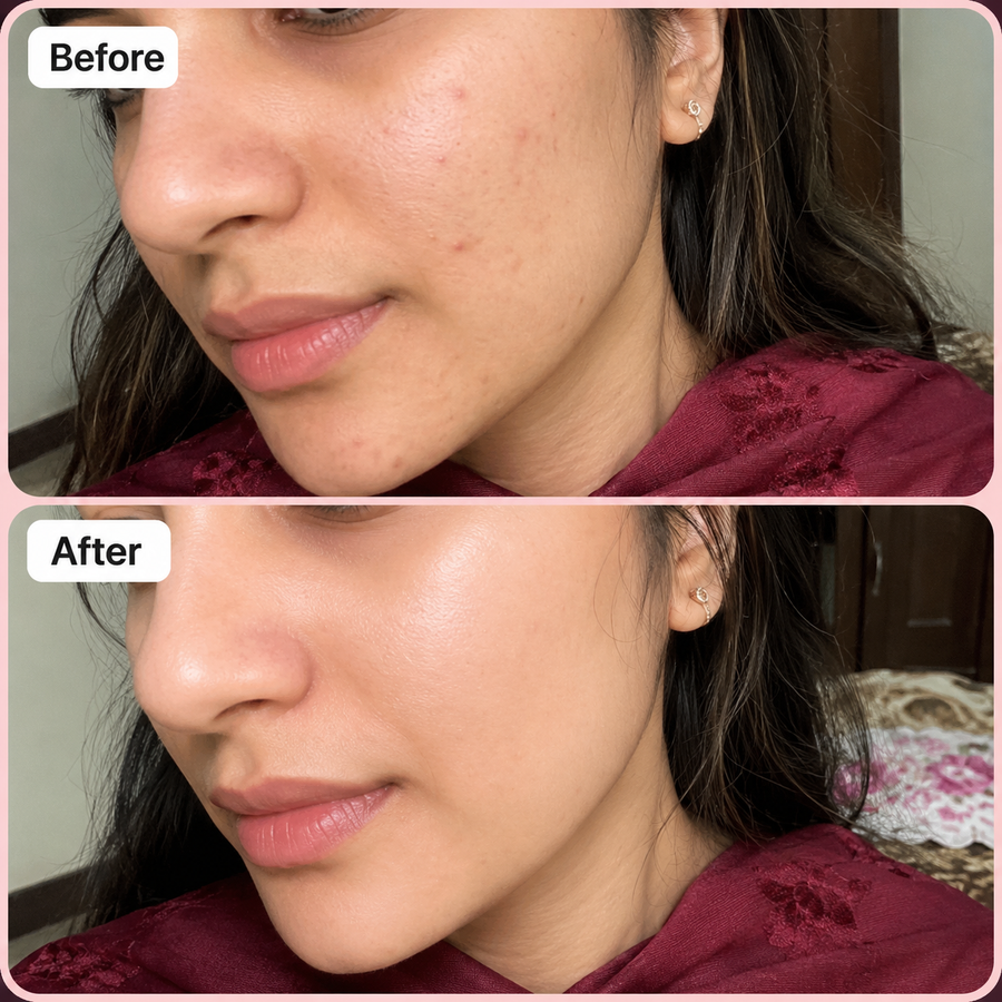 Vitamin C Skin Serum 10% results