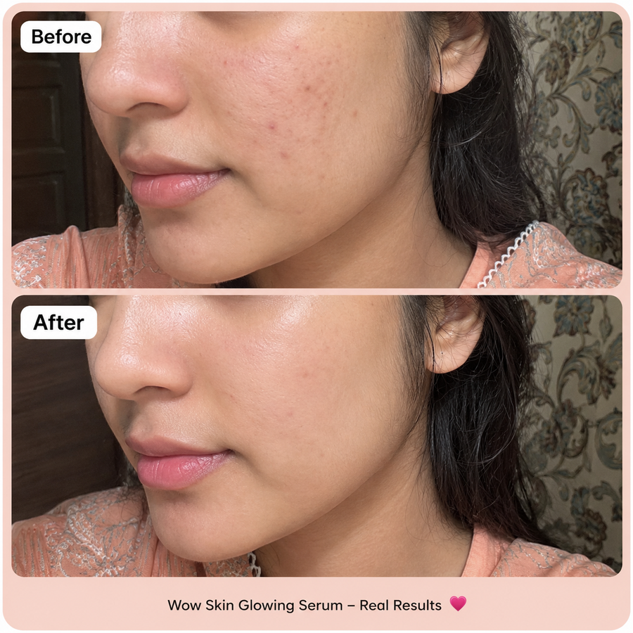 Fruity Glow Serum | Snail Mucin 96% Glowing results