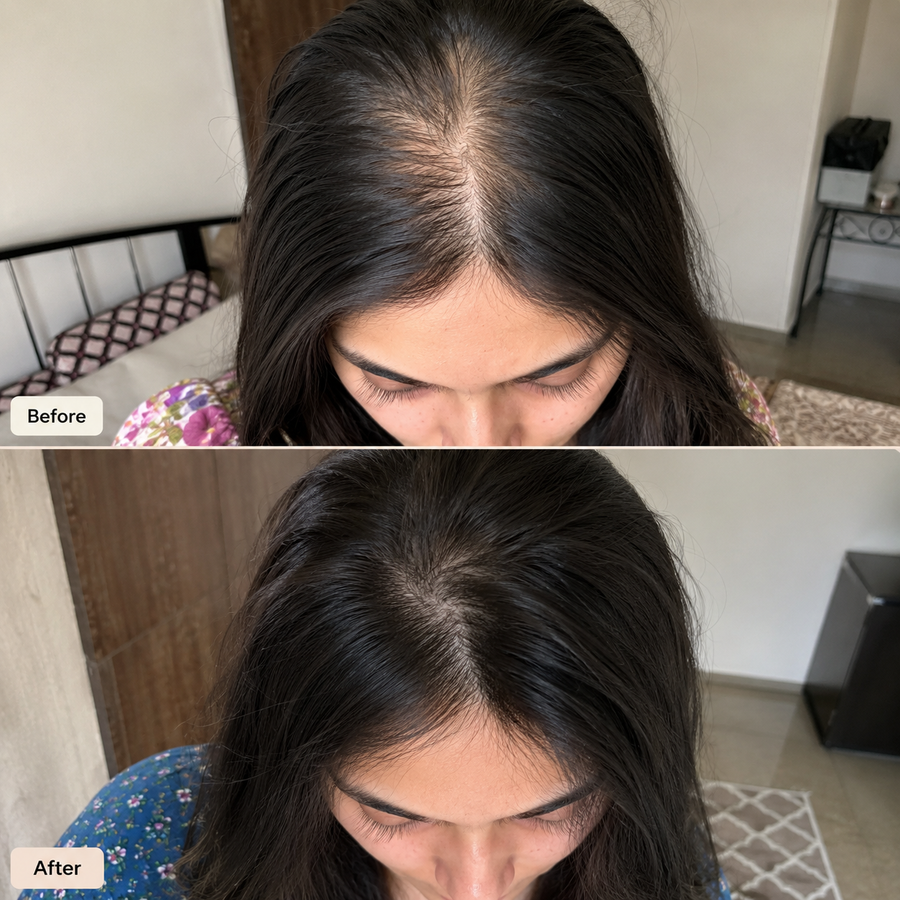 Hair Growth Oil | 16 Oils Blend Hair Food results