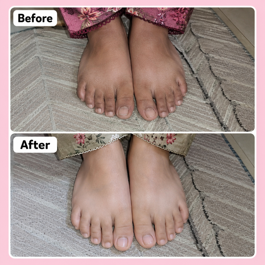 Hand & Foot Brightening Cream results
