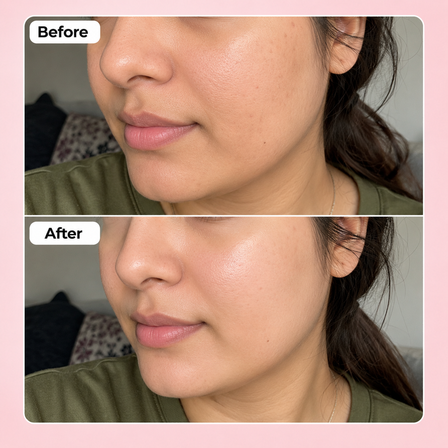 Hyaluronic Acid Serum | Hydrating Serum results